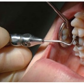 Holistic Dentistry NJ: Root Canal Alternative at HolisitcDentistryNJ.com