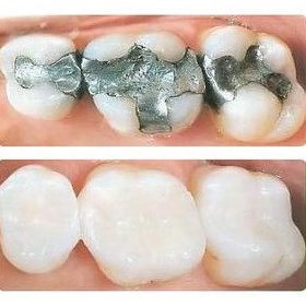 Holistic Dentistry NJ: Dr Memoli Dental Clinics in New Jersey