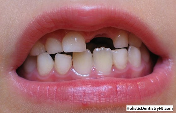 Holistic Dentistry NJ: Holistic Pediatric Dentistry in New Jersey