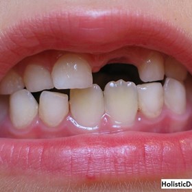 Holistic Dentistry NJ: Holistic Pediatric Dentistry in New Jersey